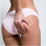 целлюлит, что такое целлюлит, опасность целлюлита, как лечить целлюлит, крем от целлюлита, антицеллюлитный массаж, диета от целлюлита, причины появления целлюлита