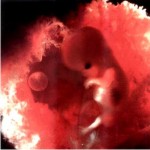 беременность, менструация, дети, ребенок