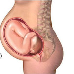 Аборт в домашних условиях